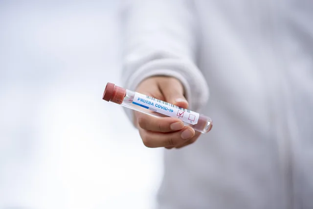 test tube, covid-19, mask, face mask, medical, pandemic, hospital, quarantine, coronavirus, test tube, covid-19, covid-19, covid-19, mask, medical, medical, medical, hospital, hospital, hospital, hospital, hospital, coronavirus, coronavirus. NEMT quote template: ten fields and three pricing structures